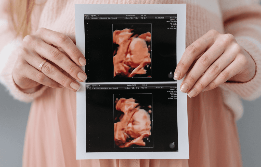 Erfahre alles über den 4D-Ultraschall in der Schwangerschaft: Vorteile, Ablauf, Kosten und der beste Zeitpunkt. Entdecke, wie du unvergessliche Erinnerungen schaffst.